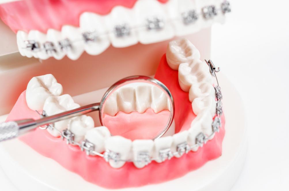 Dental Insurance